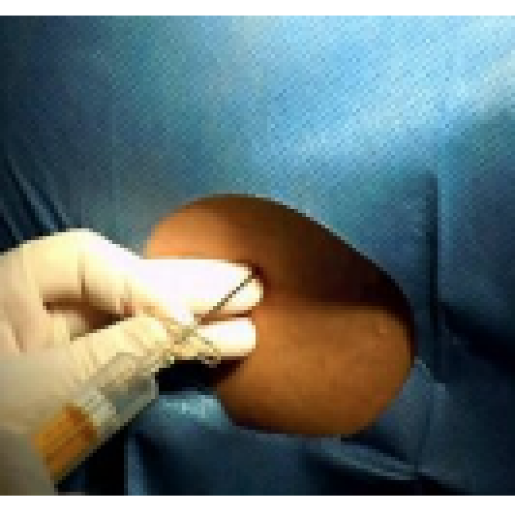 Criação da Secção de Anestesiologia Obstétrica